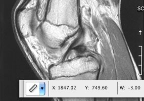 2D and 3D measurement tools screenshot