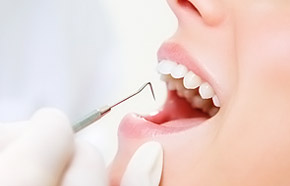 prevenir caries