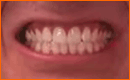 Changing Car Colours And Whitening Teeth