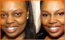 Plastic Surgery Lose Weight In Photoshop CS3