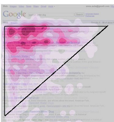 Triangle o F Pattern