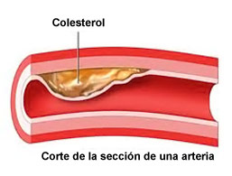 Tres Maneras de Reducir el Colesterol